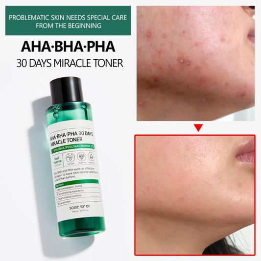 SOME BY MI AHA BHA PHA 30 Days Miracle Toner