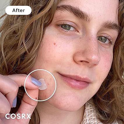 COSRX Acne Pimple Patch - Hydrocolloid Spot Stickers