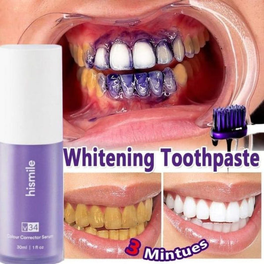 HiSmile V34 Teeth Brightening Serum – 30ml